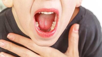 Viêm amidan quá phát trong mùa hè ở trẻ phải làm gì?