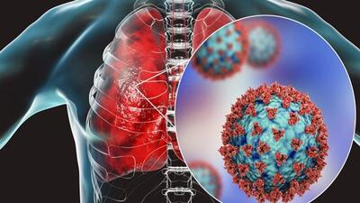 7 dấu hiệu viêm phổi cần cảnh giác lúc giao mùa
