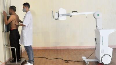 Sàng lọc lao trong cộng đồng giúp kiểm soát hiệu quả bệnh lao