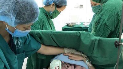 Lợi ích từ chăm sóc thiết yếu bà mẹ, trẻ sơ sinh trong và ngay sau đẻ tại bệnh viện Sản-Nhi Hưng Yên