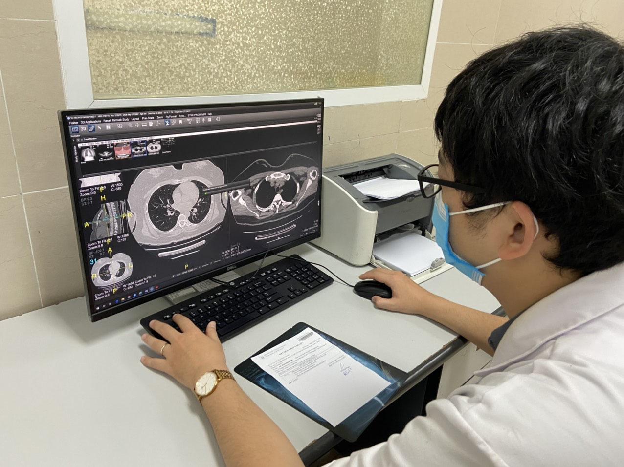 Sáng 22/5: Bộ Y tế hướng dẫn các việc nên làm để tránh tình trạng 'sương mù não' của hậu COVID-19 - Ảnh 1.