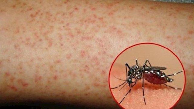 Chuyên gia chỉ cách ngăn muỗi gây bệnh sốt xuất huyết - Ảnh 1.