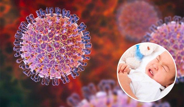 4 ghi nhớ khi trẻ mắc tiêu chảy do nhiễm virus Rota - Ảnh 2.