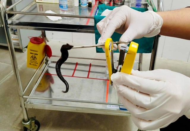 Đỉa dài 10 cm sống ký sinh trong mũi người bệnh