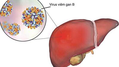 Cảnh giác với suy gan cấp
