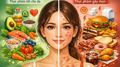 Ăn gì để da sạch mụn, mịn màng?