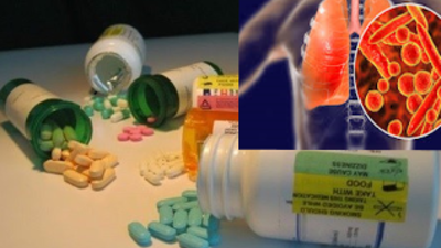 Hiểu đúng về lao kháng thuốc