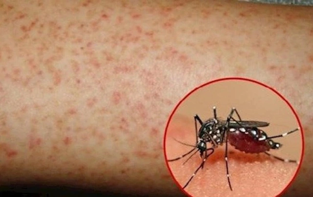 Nguy cơ dịch sốt xuất huyết gia tăng, Lâm Đồng yêu cầu tăng cường giám sát dịch