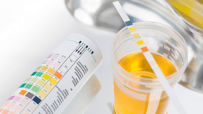 Làm thế nào để nhận biết trẻ bị rối loạn đi tiểu?