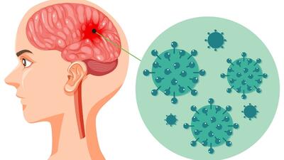 CẢNH GIÁC BỆNH NÃO MÔ CẦU NHÓM B – CHỦ ĐỘNG PHÒNG NGỪA ĐỂ BẢO VỆ SỨC KHỎE