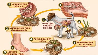 Một số bệnh ký sinh trùng thường gặp, cách nhận biết và phòng tránh