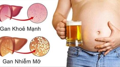 Rượu, bia: “kẻ thù thầm lặng” đang bào mòn gan và hệ tim mạch