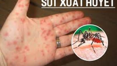 Tăng cường chủ động phòng, chống sốt xuất huyết trước mùa cao điểm năm 2026