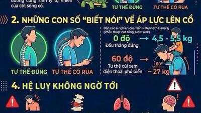 Hội chứng "cổ rùa": Mối nguy hại khi chiếc điện thoại "bẻ cong" cột sống