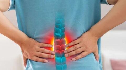 Đau lưng kéo dài, tê chân có thể là dấu hiệu của tình trạng hẹp ống sống
