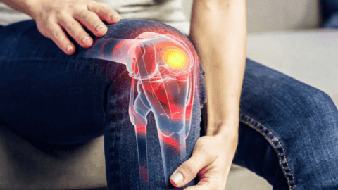 Chấn thương dây chằng khớp gối, hệ lụy nghiêm trọng nếu không điều trị kịp thời