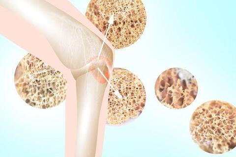 7 cách tăng cường và duy trì mật độ xương ở mọi lứa tuổi