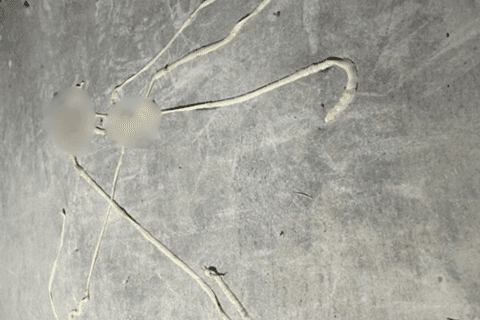 Phát hiện nhiều trường hợp nhiễm đa ký sinh trùng hiếm gặp ở Hải Phòng