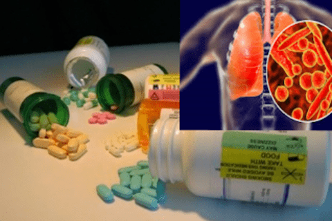 Hiểu đúng về lao kháng thuốc