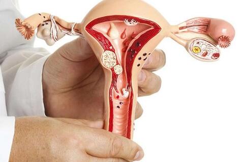 Vì sao nhân xơ tử cung khiến phụ nữ khó có thai?