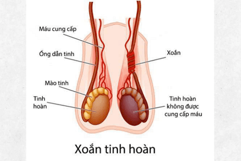 Nam sinh 14 tuổi phải cắt bỏ tinh hoàn do nhập viện muộn