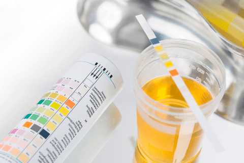 Làm thế nào để nhận biết trẻ bị rối loạn đi tiểu?