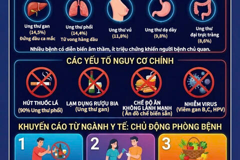 Thách thức từ sự gia tăng bệnh ung thư: Đừng để phát hiện khi đã ở giai đoạn muộn