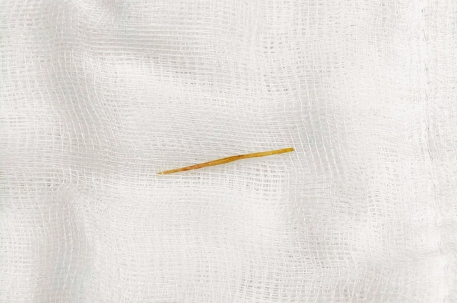 Thủng ruột do thói quen rất nhiều người mắc- Ảnh 2.