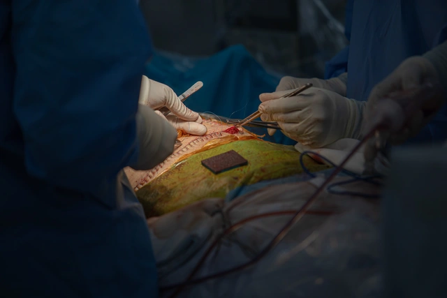 Nam sinh viên hiến gan cứu giảng viên thoát cửa tử vì suy gan cấp- Ảnh 2.