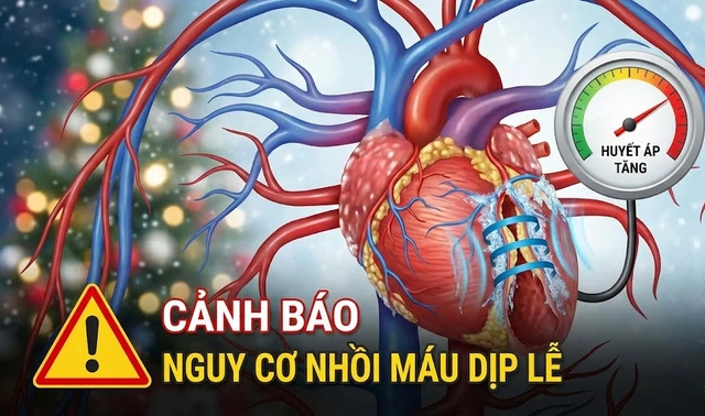 Nguy cơ nhồi máu cơ tim dịp lễ, cuối năm tăng mạnh- Ảnh 1. Nguy cơ nhồi máu cơ tim dịp lễ, cuối năm tăng mạnh- Ảnh 1.