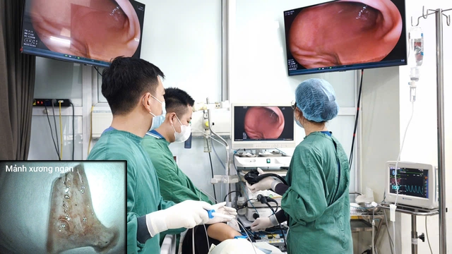 Người đàn ông cấp cứu sau bữa ngan luộc- Ảnh 3.