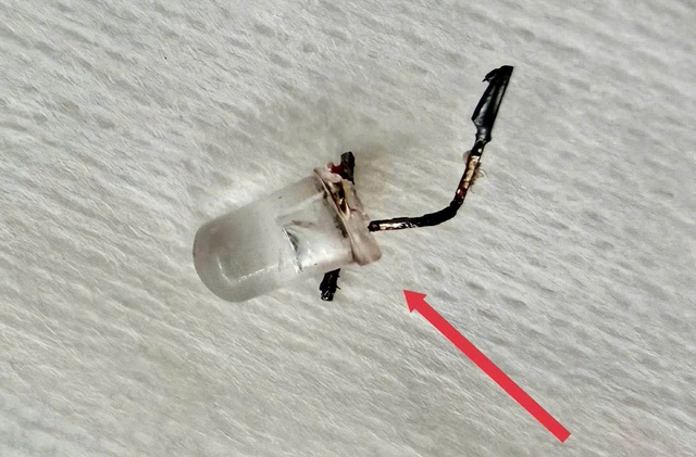 Bé 9 tháng tuổi sặc bóng đèn LED, nhập viện nguy kịch- Ảnh 2.